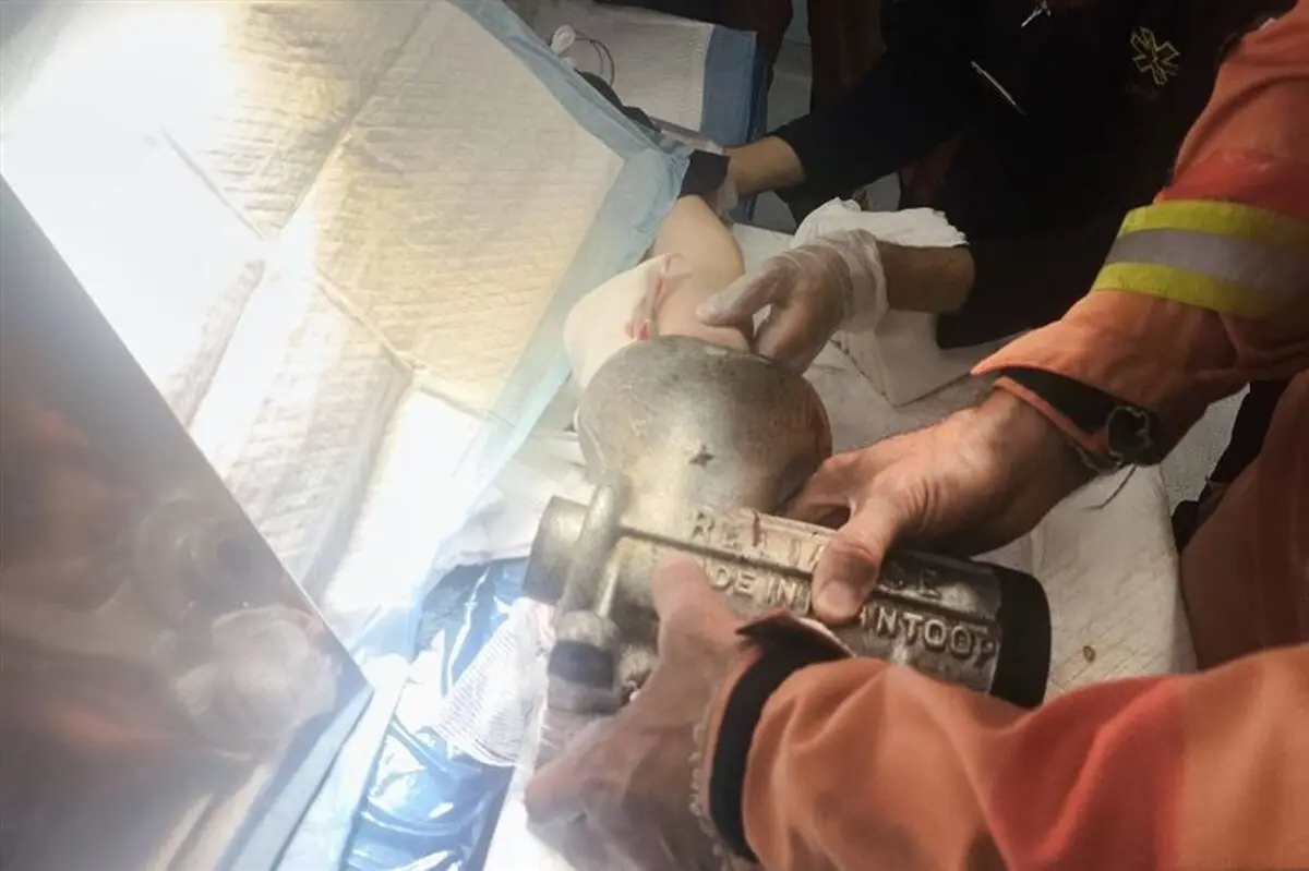 دست زن کارگر ۴۸ ساله در چرخ‌گوشت گیر کرد