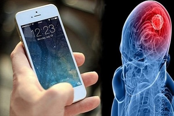 تاثیرات منفی اشعه‌های موبایل بر مغز انسان