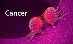 سرطان ؛ دومین عامل مرگ در کشور/۵ عامل خطر اصلی بروز سرطان‌ها