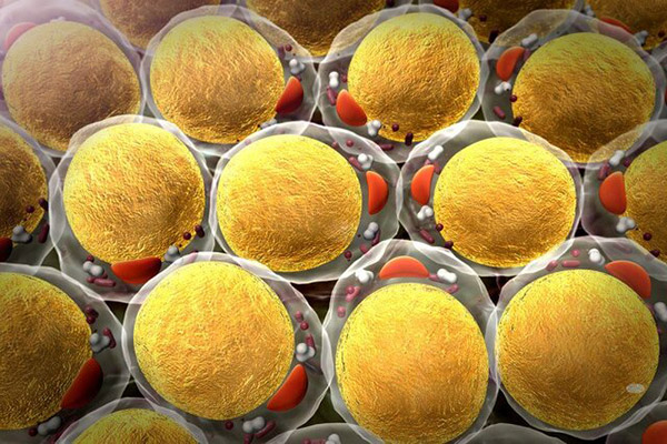 آیا چربی سلول‌ های سرطانی را تکثیر می‌کند؟