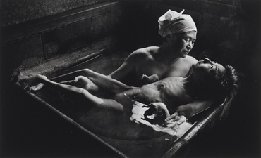 تصویر توموکو و مادر در حمام که نشان دهنده تأثیرات مخرب بیماری میناماتا بر بدن انسان است.