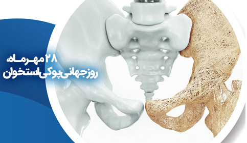 روز جهانی پوکی استخوان