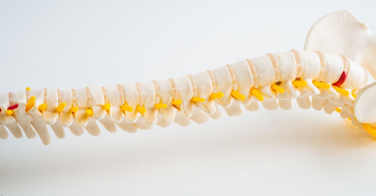 خطرناک‌ترین دیسک کمر: آشنایی با نوعی از دیسک که می‌تواند تهدیدی جدی باشد