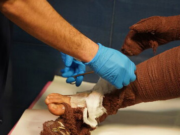 ۵۸ قطع عضو و مصدومیت ۸۲۲ نفر در حوادث چهارشنبه سوری