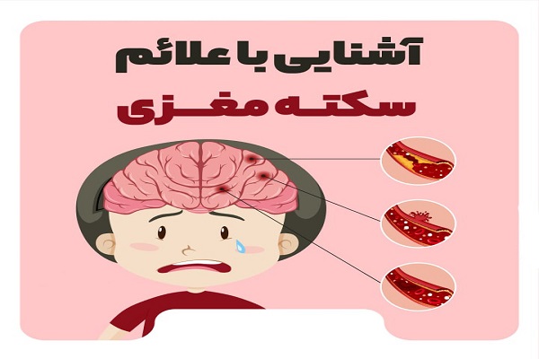 اینفوگرافیک/ آشنایی با علائم سکته مغزی
